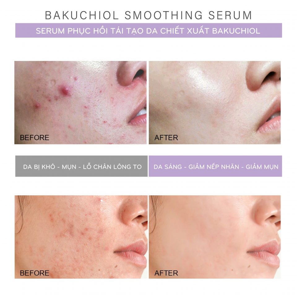 gia-cong-serum-phuc-hoi-bakuchiol