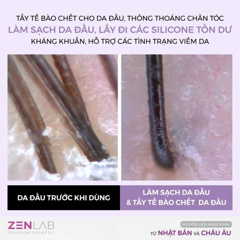 gia-cong-tay-te-bao-chet-da-dau