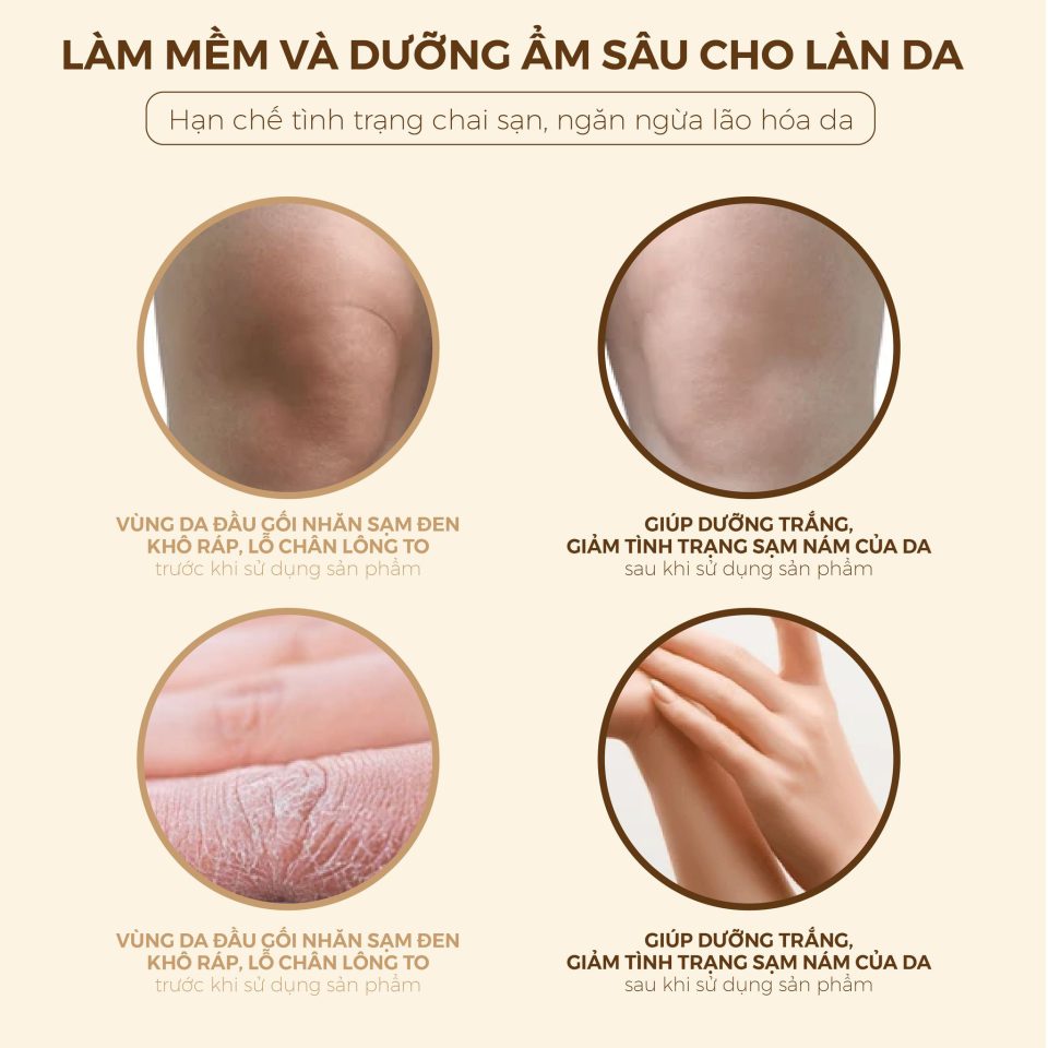 cong-dung-kem-duong-tay-khuyu-tay-got-chan
